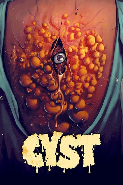 Cyst — poster